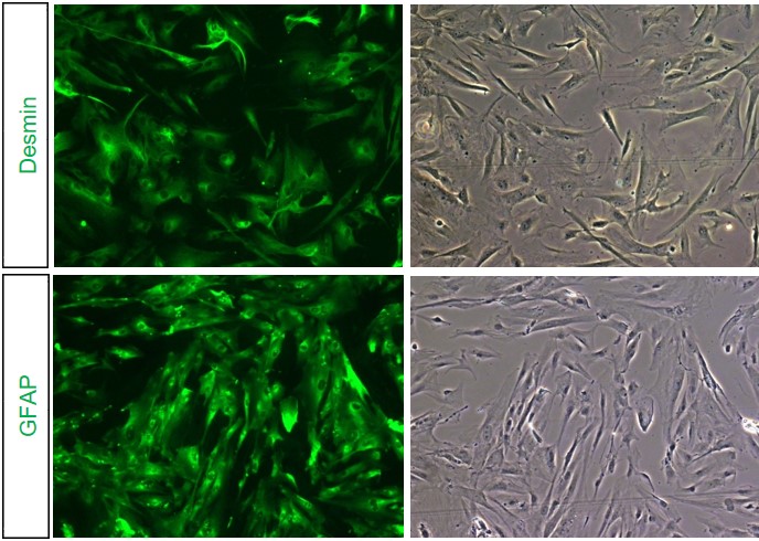 Human Hepatic Stellate Cells